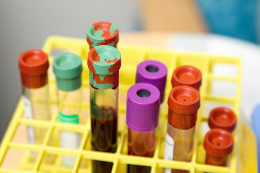 Understanding High B Vitamin Lab Results: What the Numbers Really Mean