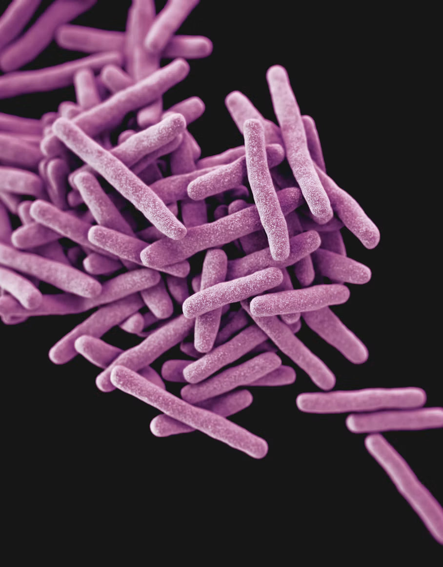 How to Choose the Best Probiotic for Women